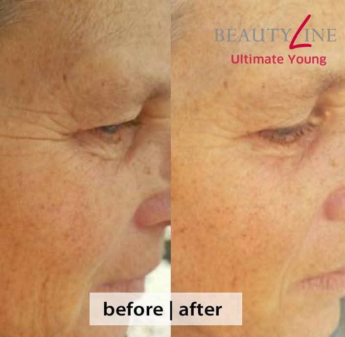 FitLine® Triple Lift Set (4ever+Ultimate Young) 6 FitLine® Triple Lift Set (4ever+Ultimate Young) (2)